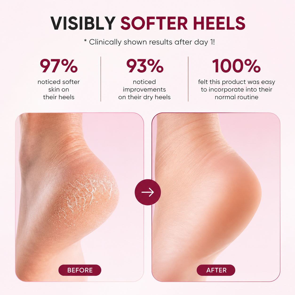 RestoraStep™ - The Overnight Spa Ritual